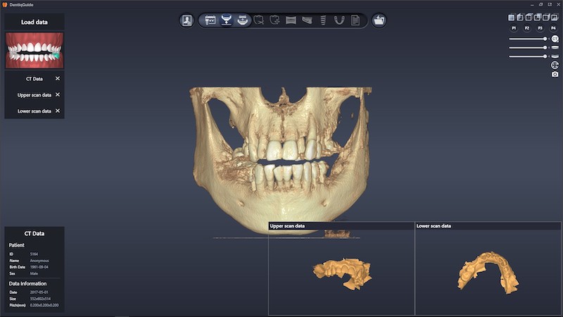 Dentiq Guide - Dentis USA