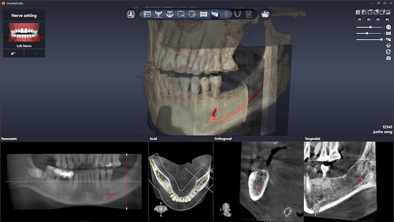 Dentiq Guide - Dentis USA